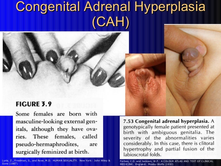 Clinical pics of hermaphrodites foto 614